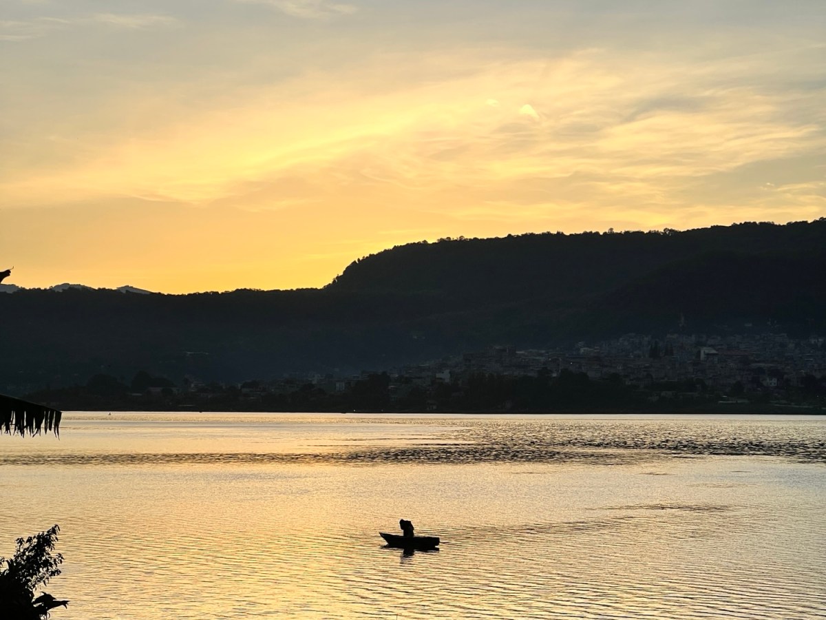 The space in between my&nbsp;brows